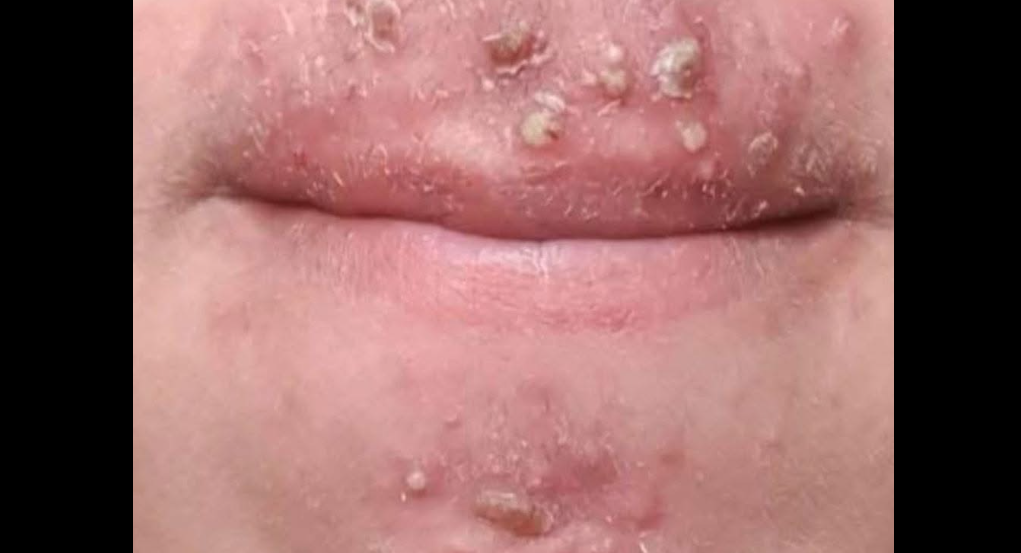 After a New Relationship Took a Serious Turn, I Noticed Something Unusual on My Skin