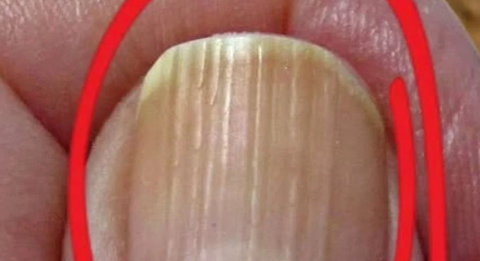 What Vertical Lines on Your Nails May Reveal About the Natural Aging Process