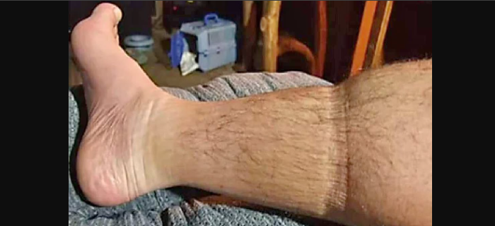6 Warning Signs That May Appear Before a Heart Attack